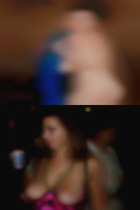 See real free local through pale skin.